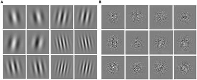 Visual motion sensitivity as an indicator of diabetic retinopathy in type 2 diabetes mellitus